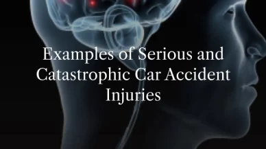 Common Injuries From a Car Accident
