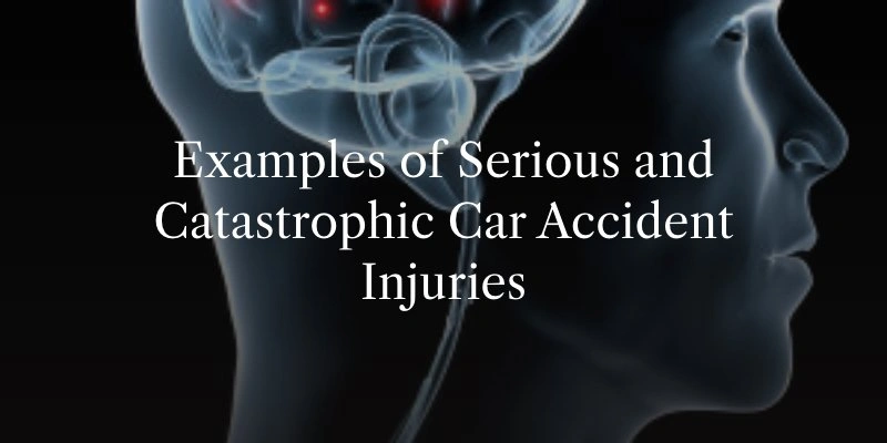 Common Injuries From a Car Accident