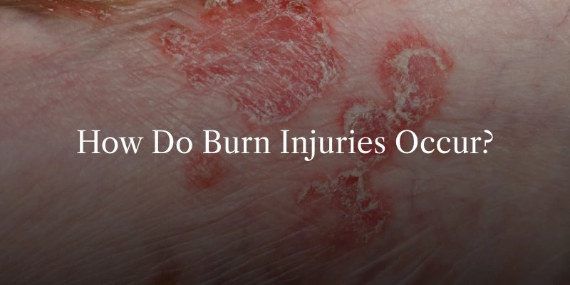 Common Causes of Burn Injuries