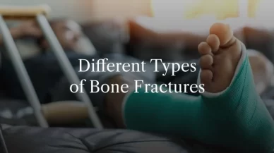 Different Types of Bone Fractures