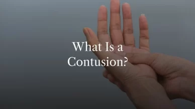 What Is a Contusion?