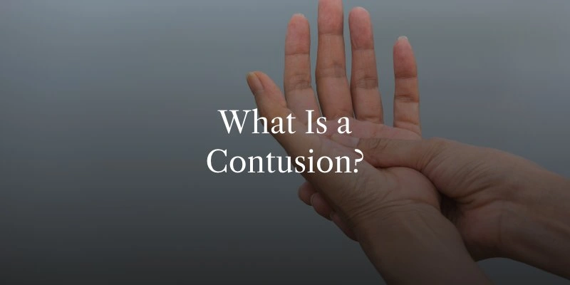 What Is a Contusion?