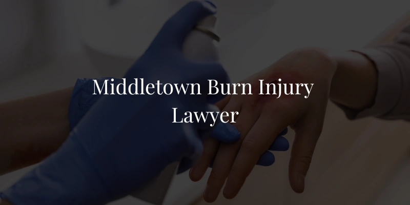 Middletown Burn Injury Lawyer
