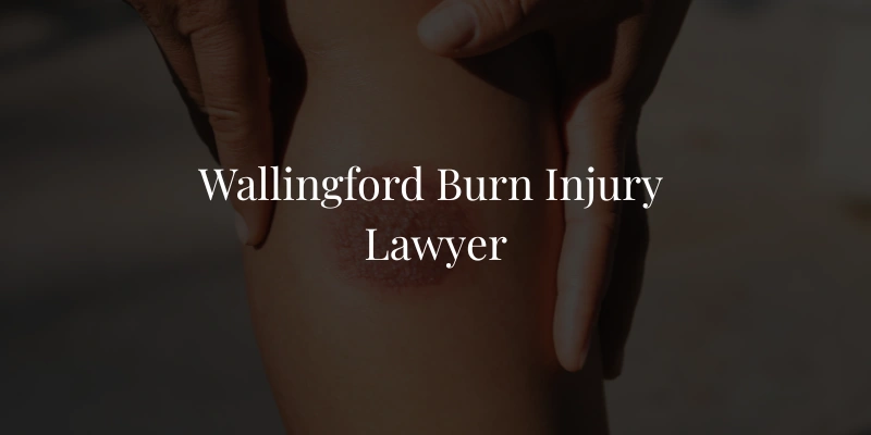 Wallingford Burn Injury Lawyer