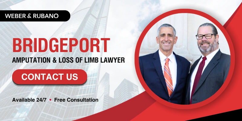 Bridgeport Amputation & Loss of Limb Lawyer