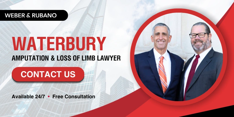 Waterbury Amputation & Loss of Limb Lawyer
