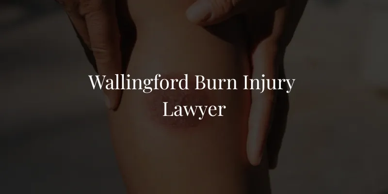 Wallingford Burn Injury Lawyer