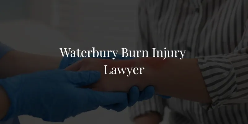 Waterbury Burn Injury Lawyer Waterbury Burn Injury Lawyer