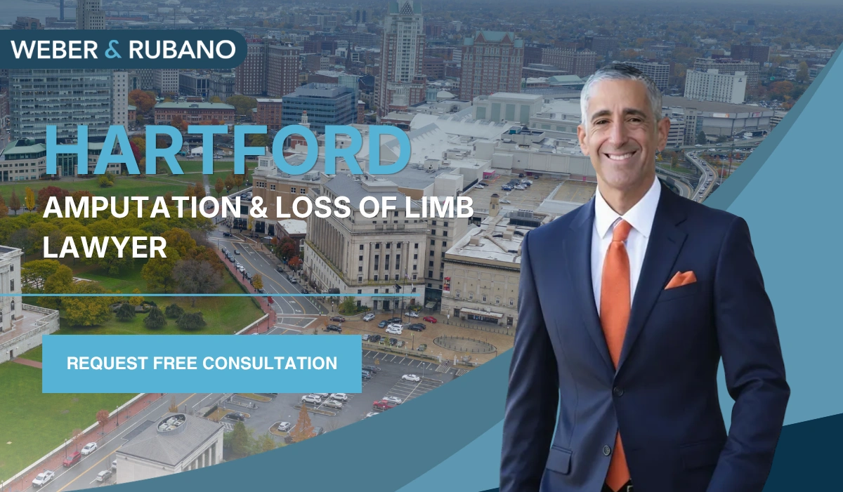 Hartford Amputation & Loss of Limb Lawyer